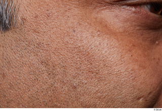 HD Face Skin Steven Hungan cheek face skin pores skin…
